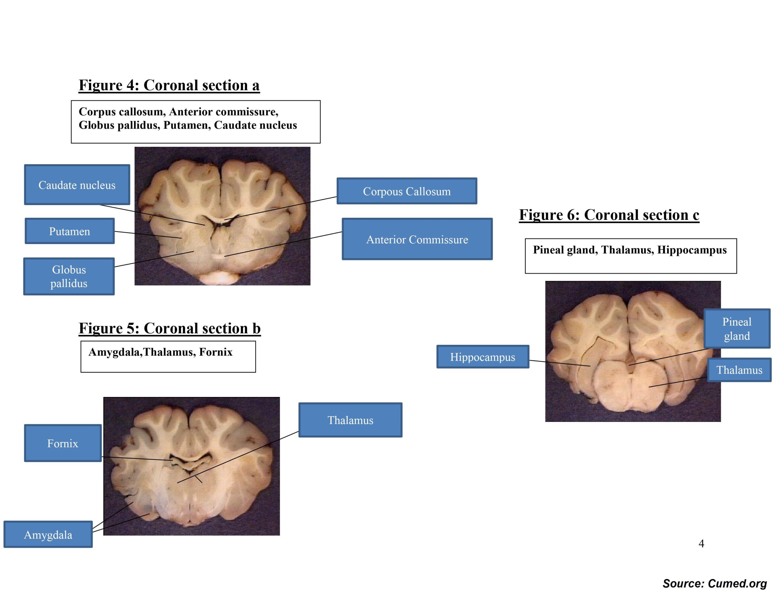 Sheep Brain Dissection Worksheet Answer Key